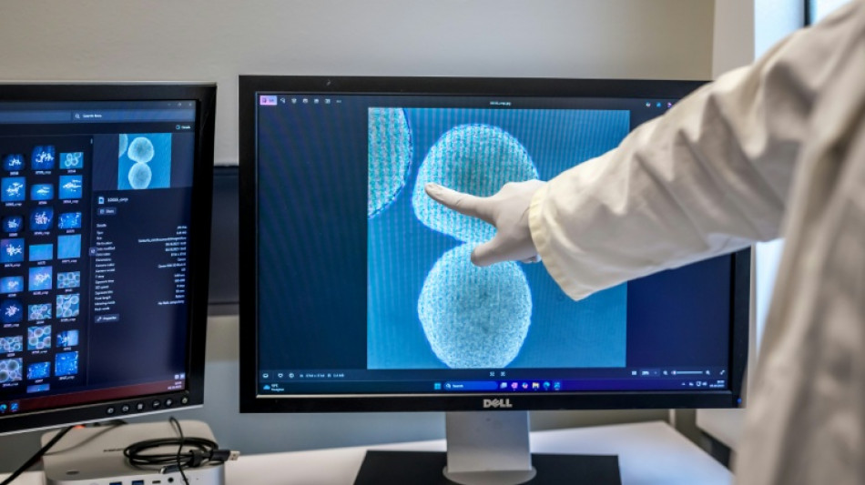 "Wetware", ces mini-cerveaux humains utilisés dans des ordinateurs