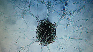 Spengono l'allarme, cos&igrave; i tumori sfuggono al sistema immunitario