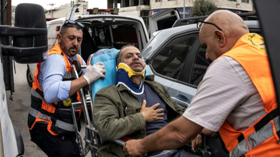 Colonos israel&iacute;es golpean a un fot&oacute;grafo de la AFP en Cisjordania